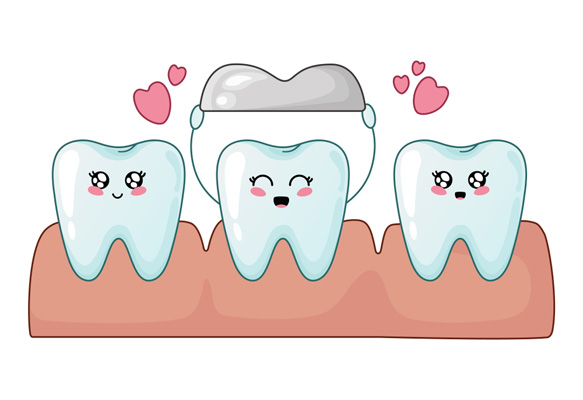 Metal Crowns Vs Porcelain Dental Crowns